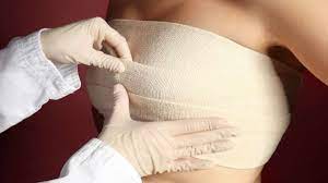 Mastopexia e mamoplastia sem prótese: estamos vivendo uma mudança de tendência?